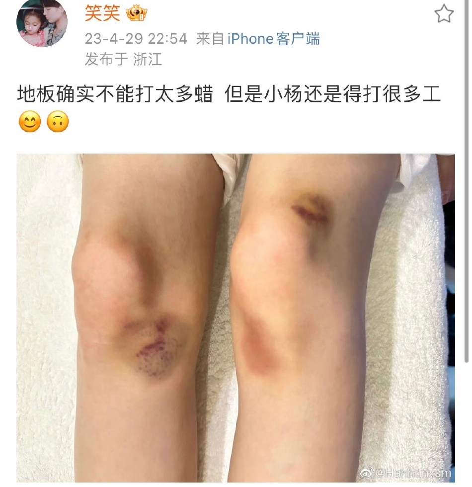 鞠婧祎晒膝盖受伤照 表示“小杨还是得打很多工”封面图