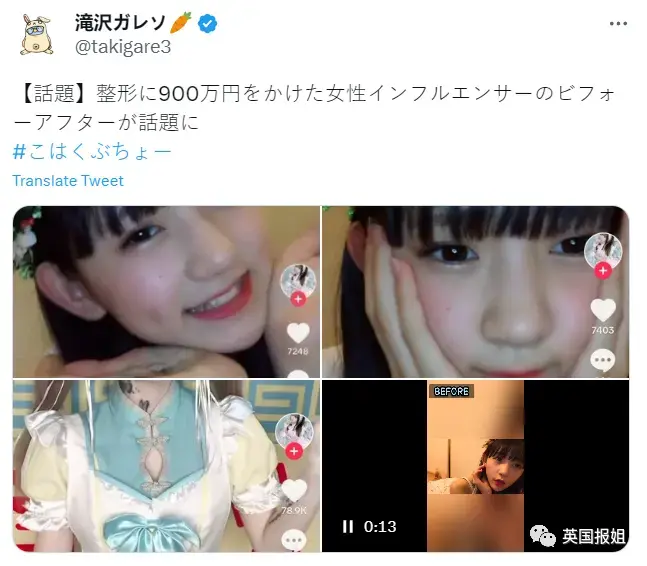 15岁日本美少女网红整容失败，对比照震惊网友！母亲竟纵容她花900万“换头”